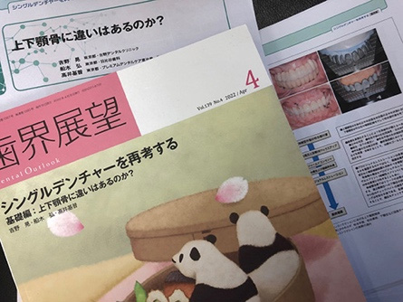 シングルデンチャー