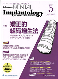 インプラントの成功は咬合にあり1
